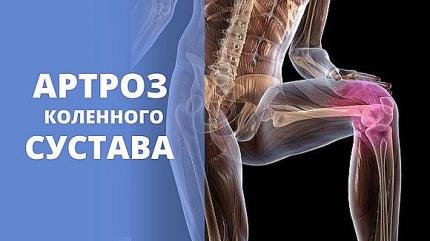 Лечение коленного сустава по Бубновскому (2015) WebRip